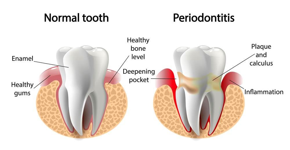 Periodontist Provo