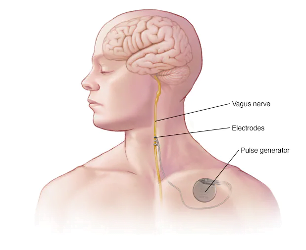 Vagus Nerve